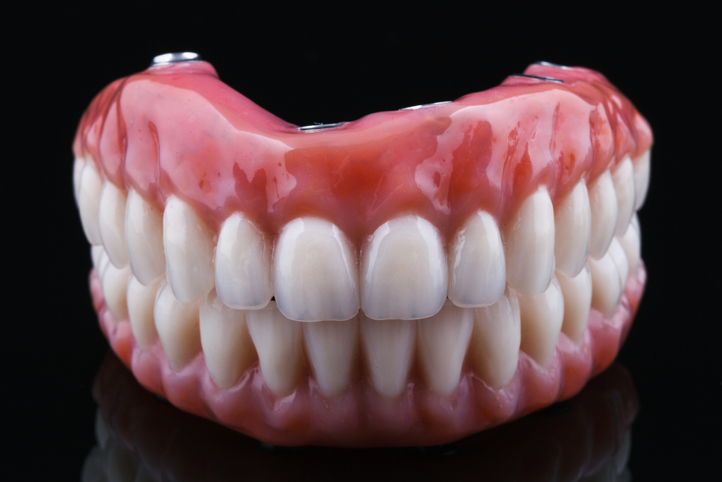 Protocolo com 4 implantes dentários suportando prótese fixa