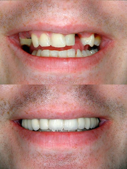 Antes e depois do Protocolo 72h